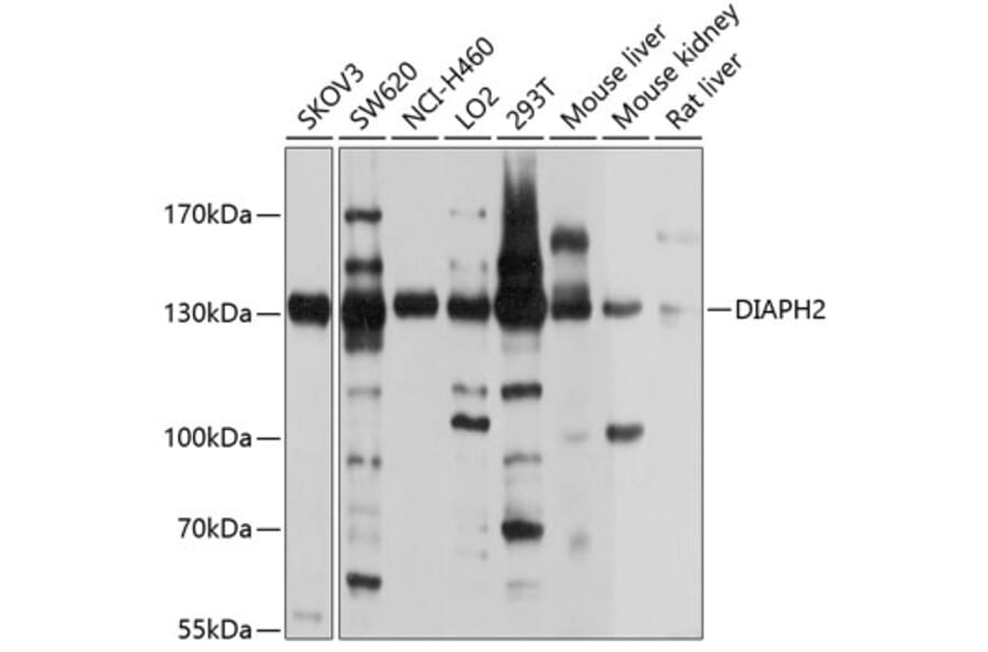Western Blot - Anti-DIAPH2/DIA Antibody (A12839) - Antibodies.com