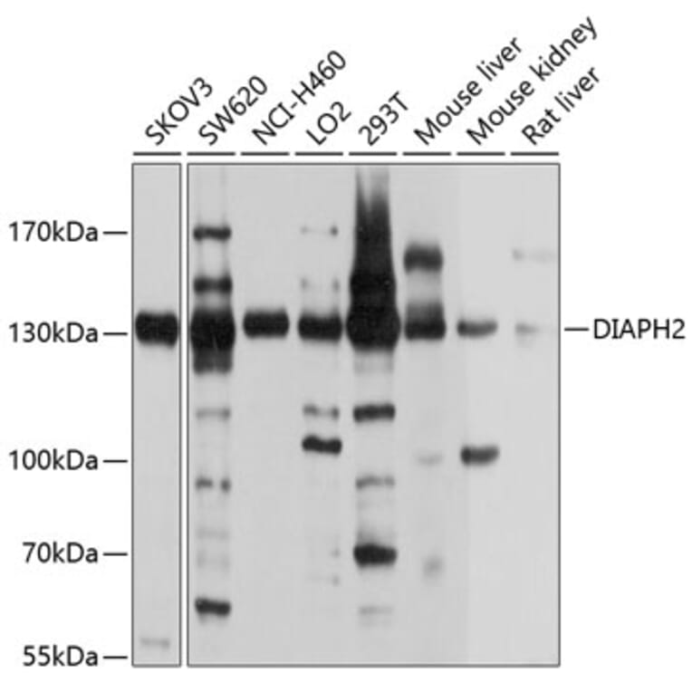 Western Blot - Anti-DIAPH2/DIA Antibody (A12839) - Antibodies.com
