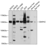 Western Blot - Anti-DIAPH2/DIA Antibody (A12839) - Antibodies.com