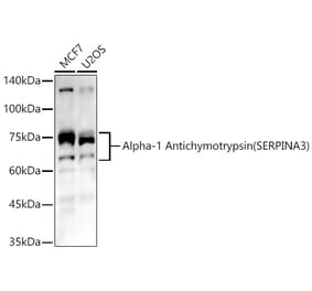 Western Blot - Anti-AACT Antibody (A12840) - Antibodies.com