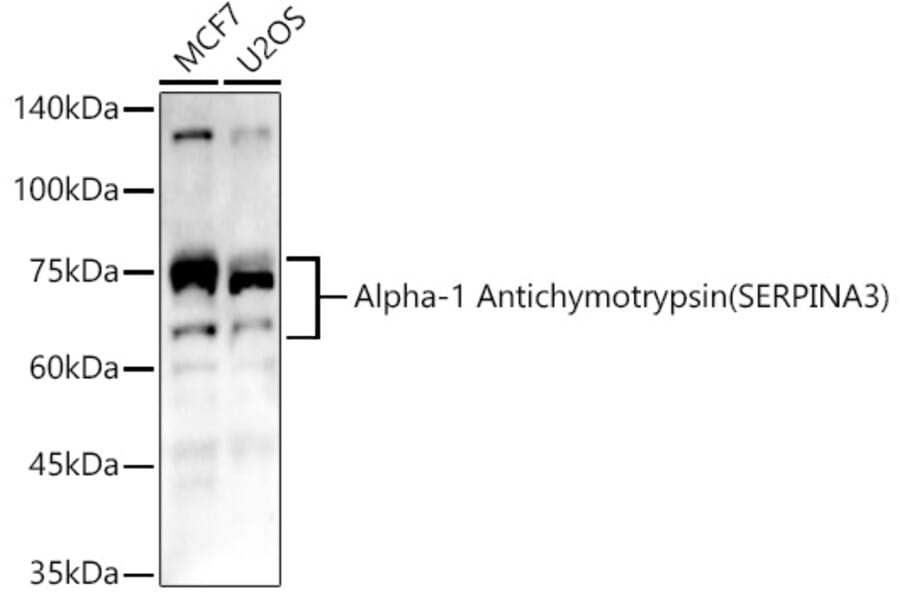 Western Blot - Anti-AACT Antibody (A12840) - Antibodies.com