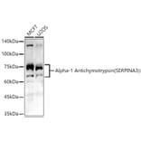 Western Blot - Anti-AACT Antibody (A12840) - Antibodies.com