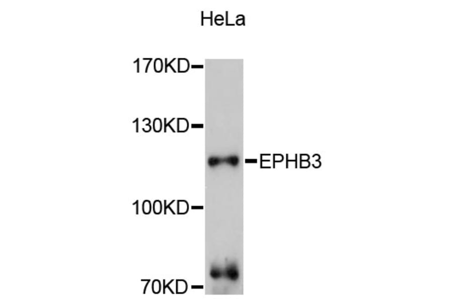Western Blot - Anti-EPHB3 Antibody (A10214) - Antibodies.com