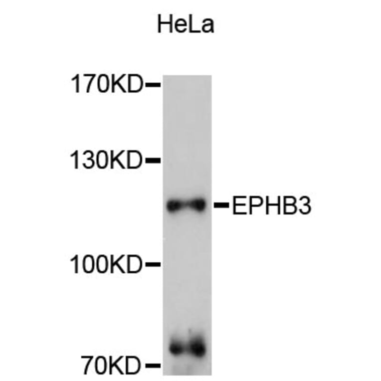 Western Blot - Anti-EPHB3 Antibody (A10214) - Antibodies.com