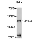 Western Blot - Anti-EPHB3 Antibody (A10214) - Antibodies.com