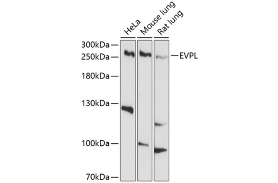 Western Blot - Anti-EVPL Antibody (A12842) - Antibodies.com