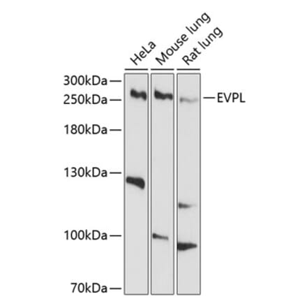 Western Blot - Anti-EVPL Antibody (A12842) - Antibodies.com
