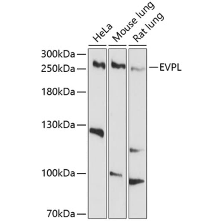 Western Blot - Anti-EVPL Antibody (A12842) - Antibodies.com