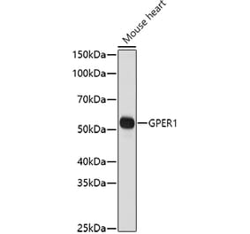 Western Blot - Anti-G-protein coupled receptor 30 Antibody (A12843) - Antibodies.com