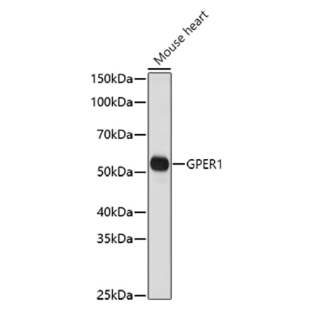 Western Blot - Anti-G-protein coupled receptor 30 Antibody (A12843) - Antibodies.com