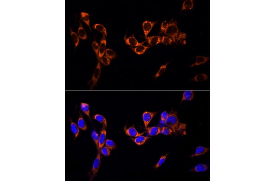 Immunofluorescence - Anti-G-protein coupled receptor 30 Antibody (A12843) - Antibodies.com