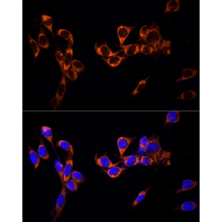 Immunofluorescence - Anti-G-protein coupled receptor 30 Antibody (A12843) - Antibodies.com