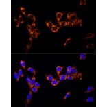 Immunofluorescence - Anti-G-protein coupled receptor 30 Antibody (A12843) - Antibodies.com