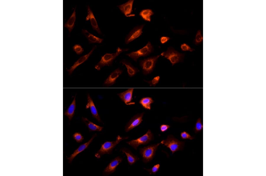Immunofluorescence - Anti-G-protein coupled receptor 30 Antibody (A12843) - Antibodies.com