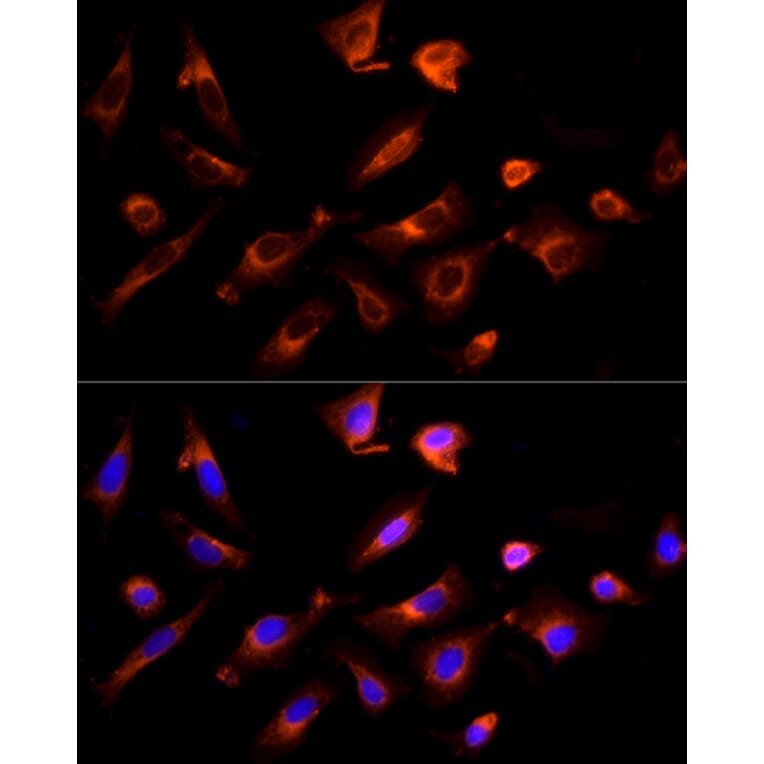 Immunofluorescence - Anti-G-protein coupled receptor 30 Antibody (A12843) - Antibodies.com