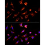 Immunofluorescence - Anti-G-protein coupled receptor 30 Antibody (A12843) - Antibodies.com