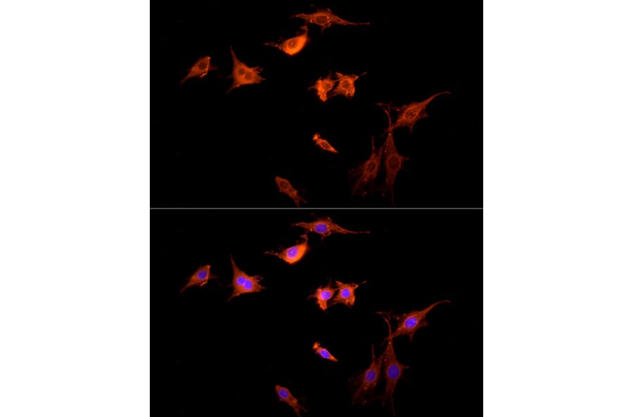 Immunofluorescence - Anti-G-protein coupled receptor 30 Antibody (A12843) - Antibodies.com