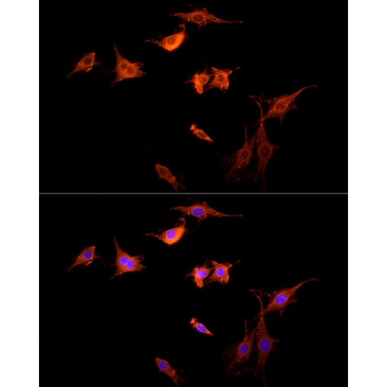 Immunofluorescence - Anti-G-protein coupled receptor 30 Antibody (A12843) - Antibodies.com