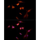 Immunofluorescence - Anti-G-protein coupled receptor 30 Antibody (A12843) - Antibodies.com