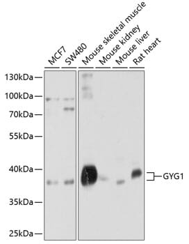 Western blot analysis of extracts of various cell lines, using Anti-GYG1 Antibody (A10218) at 1:1,000 dilution.
Secondary antibody: Goat Anti-Rabbit IgG (H+L) (HRP) (AS014) at 1:10,000 dilution.
Lysates / proteins: 25µg per lane.
Blocking buffer: 3% non-fat dry milk in TBST.
Detection: ECL Basic Kit (RM00020).
Exposure time: 5s.