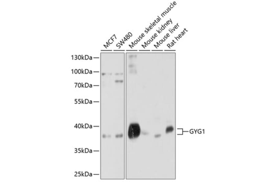 Western Blot - Anti-Glycogenin 1 Antibody (A12844) - Antibodies.com