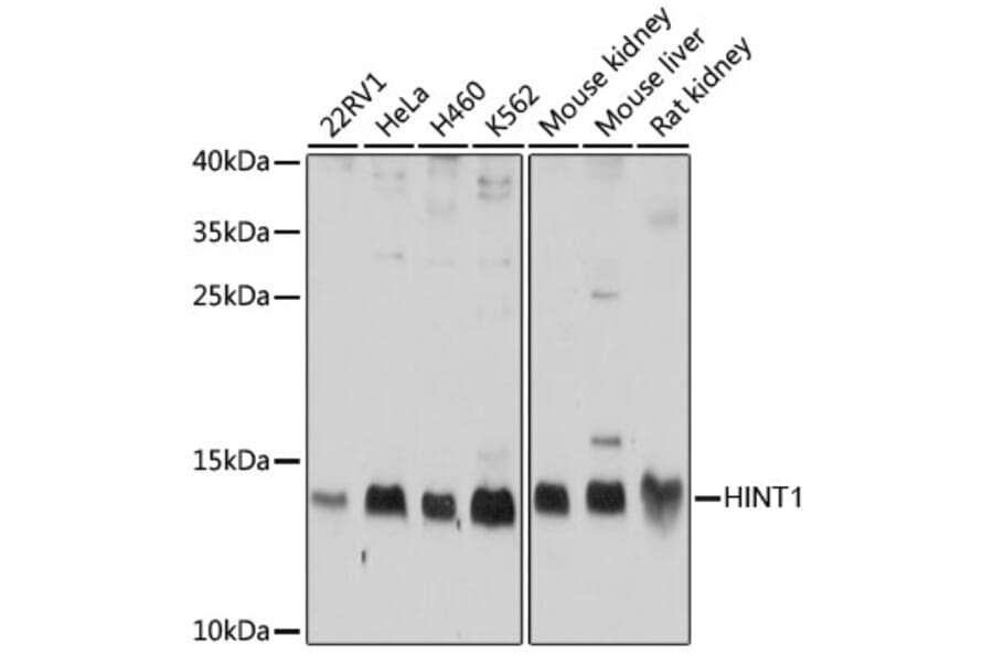 Western Blot - Anti-HINT1 Antibody (A10221) - Antibodies.com