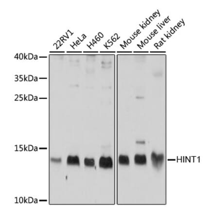 Western Blot - Anti-HINT1 Antibody (A10221) - Antibodies.com