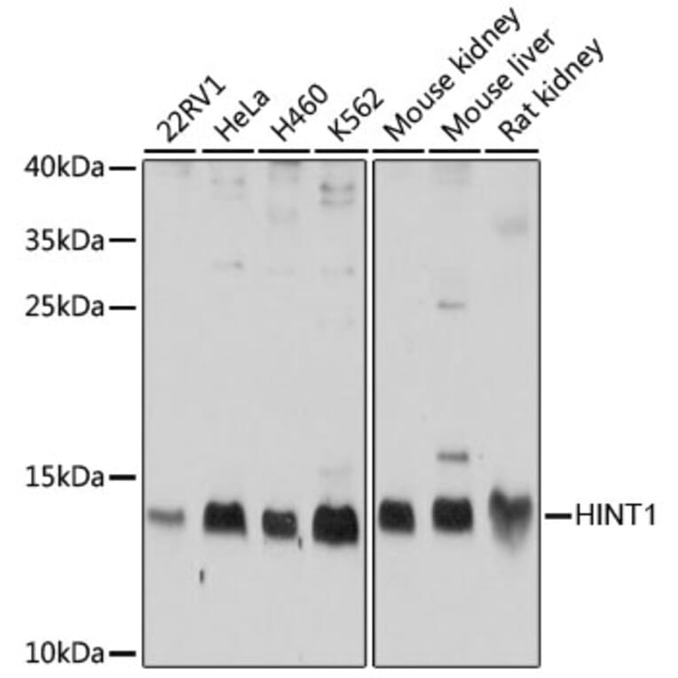 Western Blot - Anti-HINT1 Antibody (A10221) - Antibodies.com