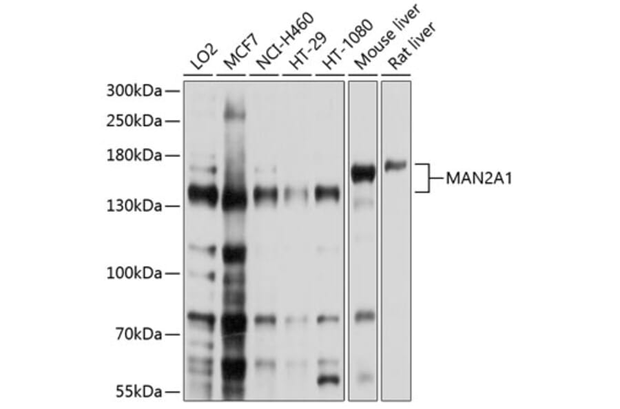 Western Blot - Anti-Mannosidase II/MAN2A1 Antibody (A12846) - Antibodies.com