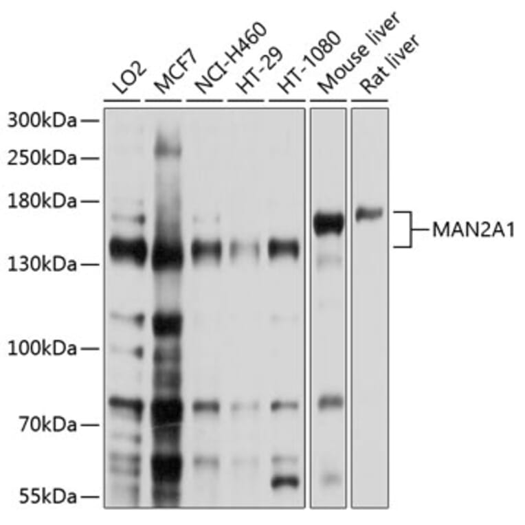Western Blot - Anti-Mannosidase II/MAN2A1 Antibody (A12846) - Antibodies.com