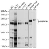 Western Blot - Anti-Mannosidase II/MAN2A1 Antibody (A12846) - Antibodies.com