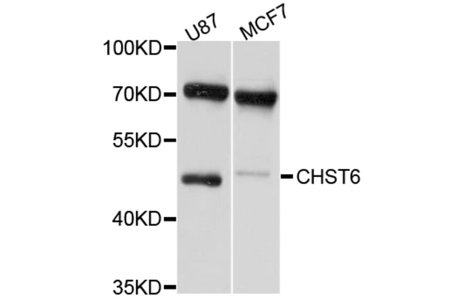 Western Blot - Anti-CHST6 Antibody (A10229) - Antibodies.com
