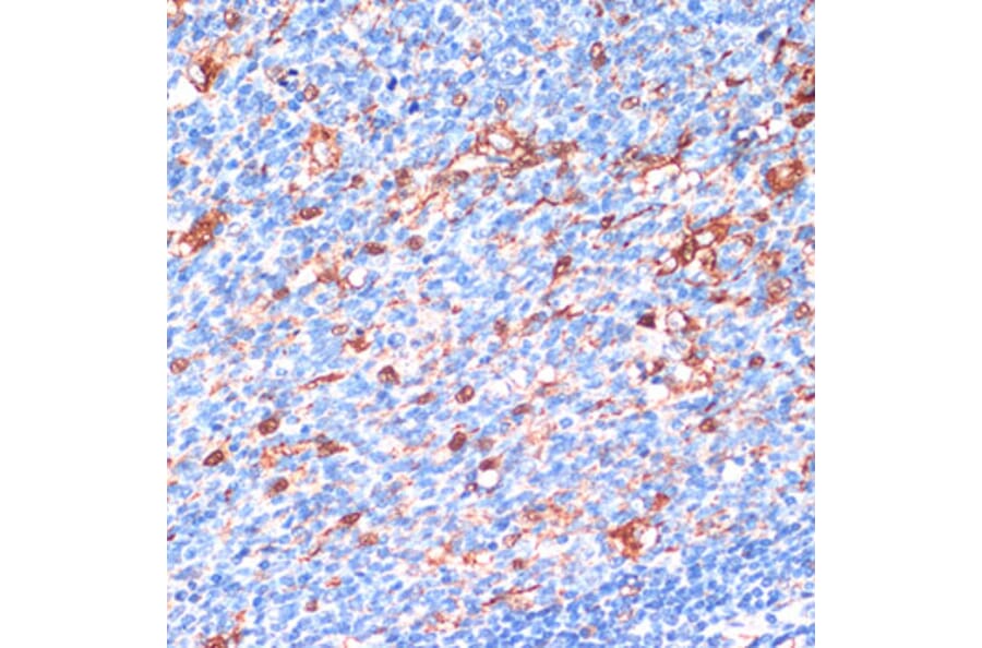 Immunohistochemistry - Anti-14-3-3 beta/alpha Antibody (A12848) - Antibodies.com