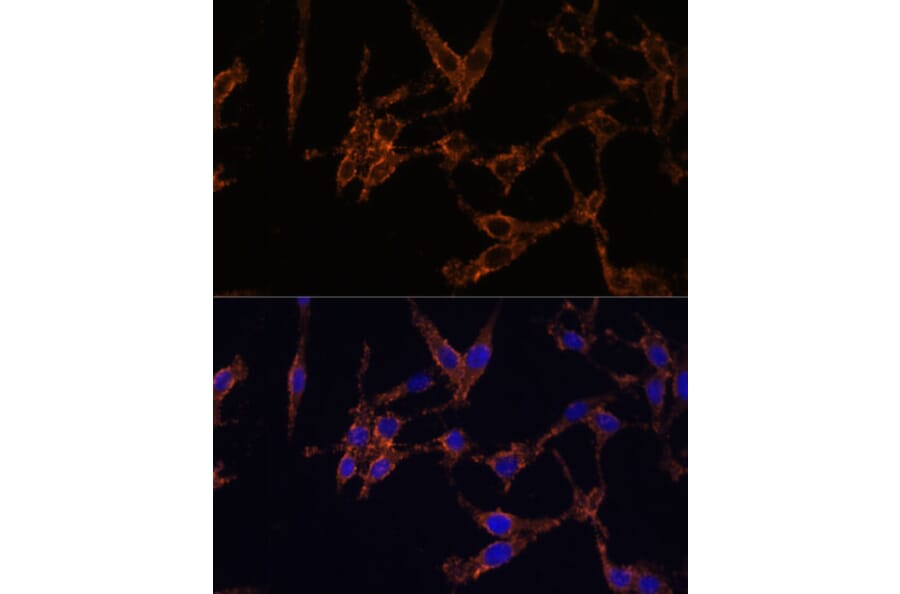 Immunofluorescence - Anti-14-3-3 beta/alpha Antibody (A12848) - Antibodies.com