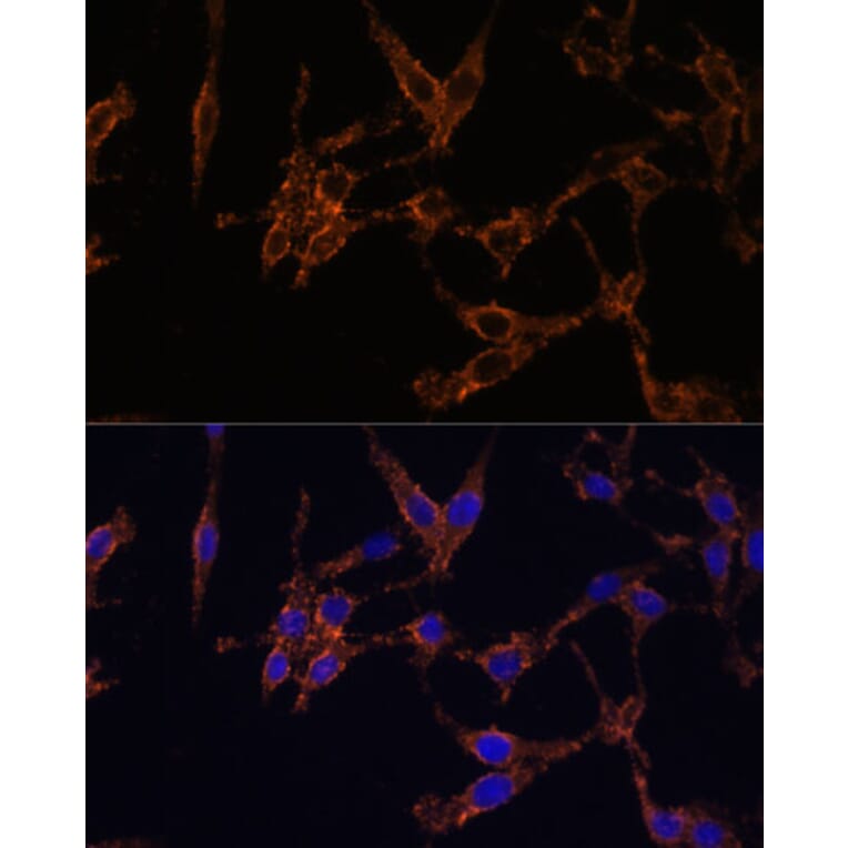 Immunofluorescence - Anti-14-3-3 beta/alpha Antibody (A12848) - Antibodies.com
