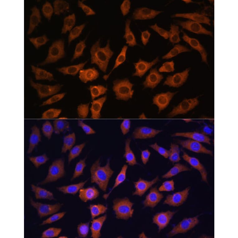 Immunofluorescence - Anti-14-3-3 beta/alpha Antibody (A12848) - Antibodies.com