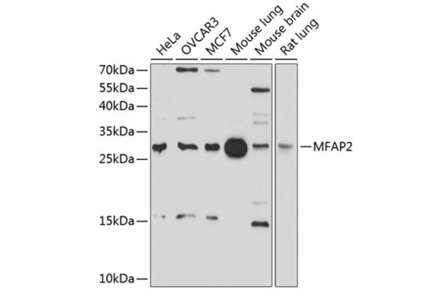 Western Blot - Anti-MAGP1 Antibody (A12849) - Antibodies.com