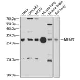 Western Blot - Anti-MAGP1 Antibody (A12849) - Antibodies.com
