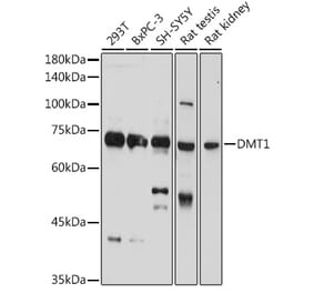 Western Blot - Anti-DMT1 Antibody (A12850) - Antibodies.com