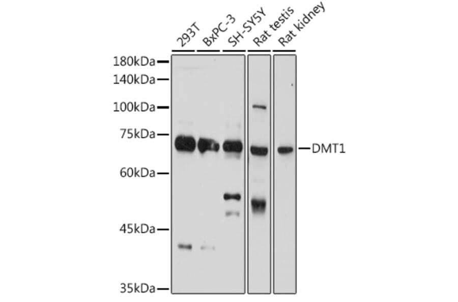 Western Blot - Anti-DMT1 Antibody (A12850) - Antibodies.com