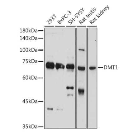 Western Blot - Anti-DMT1 Antibody (A12850) - Antibodies.com