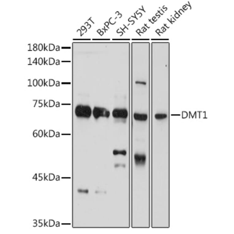 Western Blot - Anti-DMT1 Antibody (A12850) - Antibodies.com