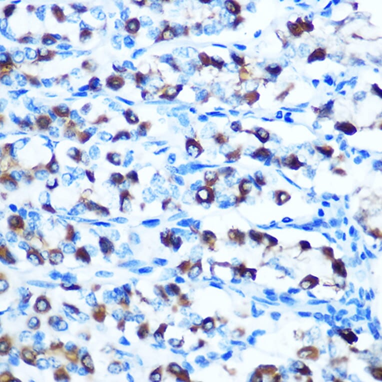 Immunohistochemistry - Anti-DMT1 Antibody (A12850) - Antibodies.com
