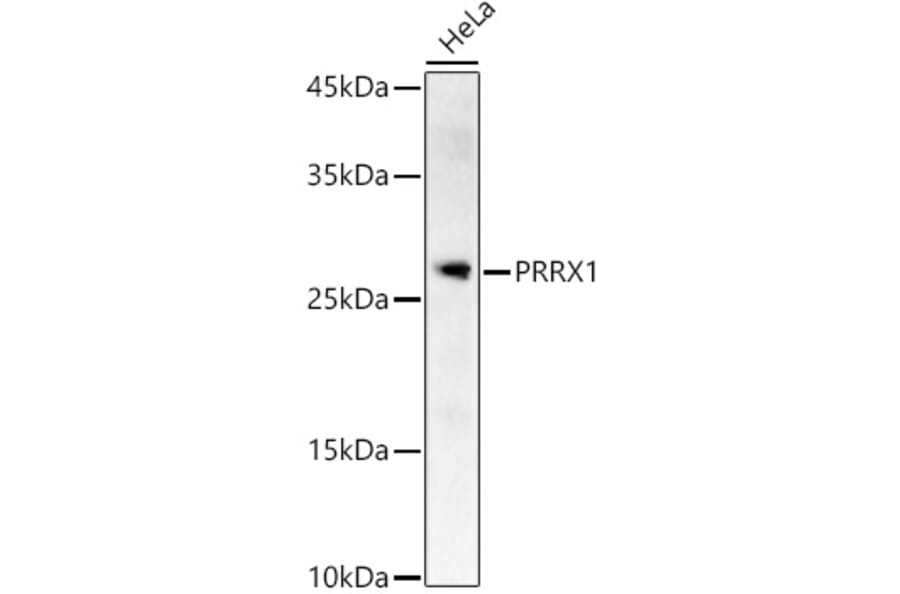 Western Blot - Anti-PRX-1 Antibody (A12852) - Antibodies.com