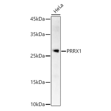 Western Blot - Anti-PRX-1 Antibody (A12852) - Antibodies.com