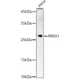 Western Blot - Anti-PRX-1 Antibody (A12852) - Antibodies.com