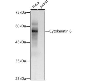 Western Blot - Anti-Cytokeratin 8 Antibody (A12853) - Antibodies.com