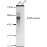 Western Blot - Anti-Cytokeratin 8 Antibody (A12853) - Antibodies.com