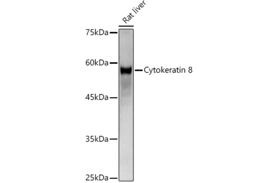 Western Blot - Anti-Cytokeratin 8 Antibody (A12853) - Antibodies.com