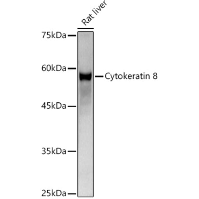 Western Blot - Anti-Cytokeratin 8 Antibody (A12853) - Antibodies.com